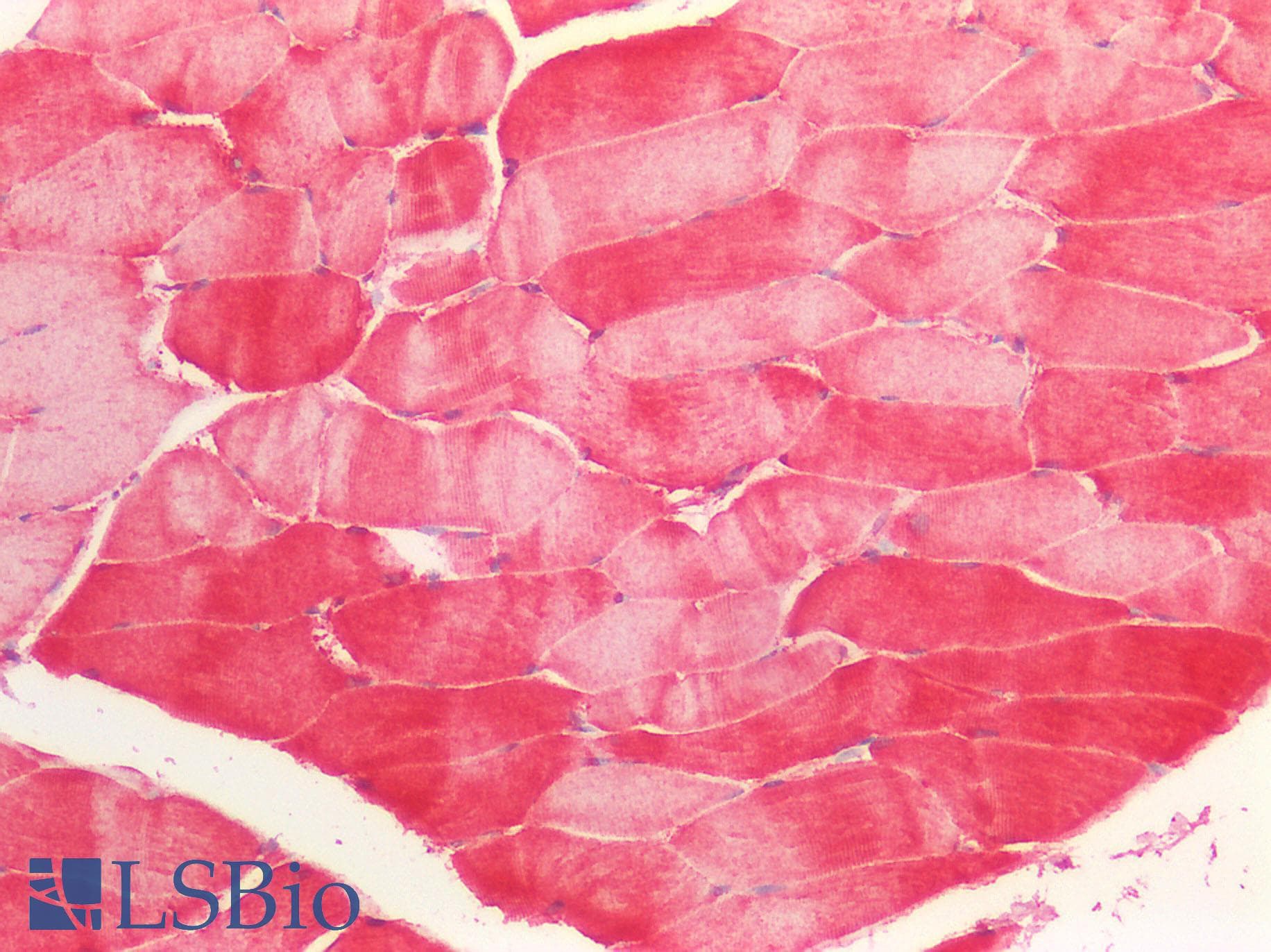 MAP4K3 / GLK Antibody