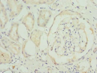 Polyclonal Rabbit anti-Human TMEM1 / TRAPPC10 Antibody (IHC)