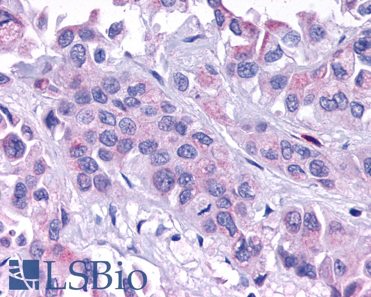 IHC-plus™ Polyclonal Rabbit anti-Human ADGRL4 / ELTD1 Antibody (N-Terminus, IHC)