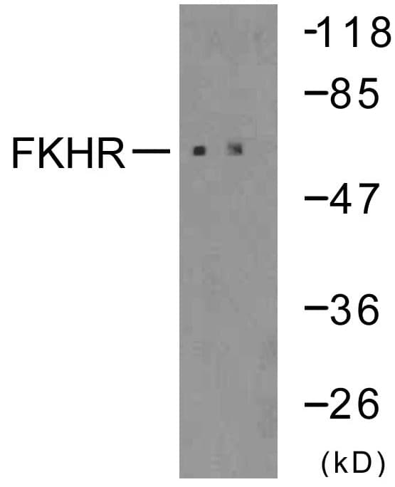 FOXO1 / FKHR Antibody (aa286-335)