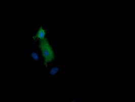 MAP2K1 / MKK1 / MEK1 Antibody (clone OTI4E1)