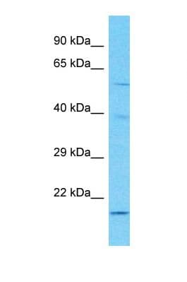 GATB / PET112 Antibody (aa33-82)