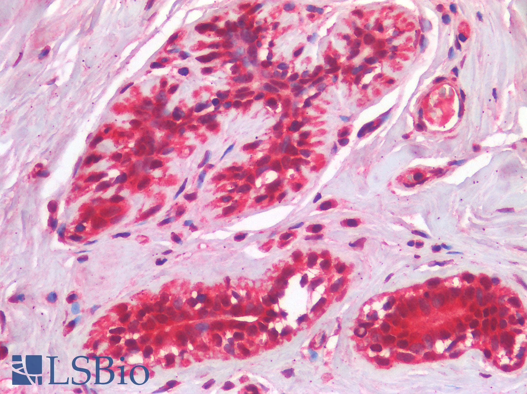 IHC-plus™ IL3RA / CD123 Antibody