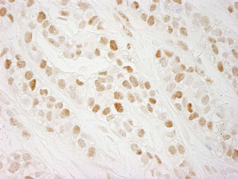 CHTF18 / RUVBL Antibody (aa25-75)