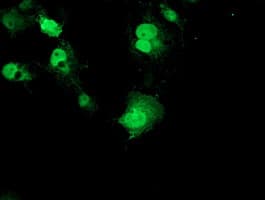 RPS6KB1 / P70S6K / S6K Antibody (clone OTI1G4, Carrier-free)