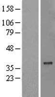MTCH2 Protein (Over-Expression Lysate Myc-DDK (Flag))
