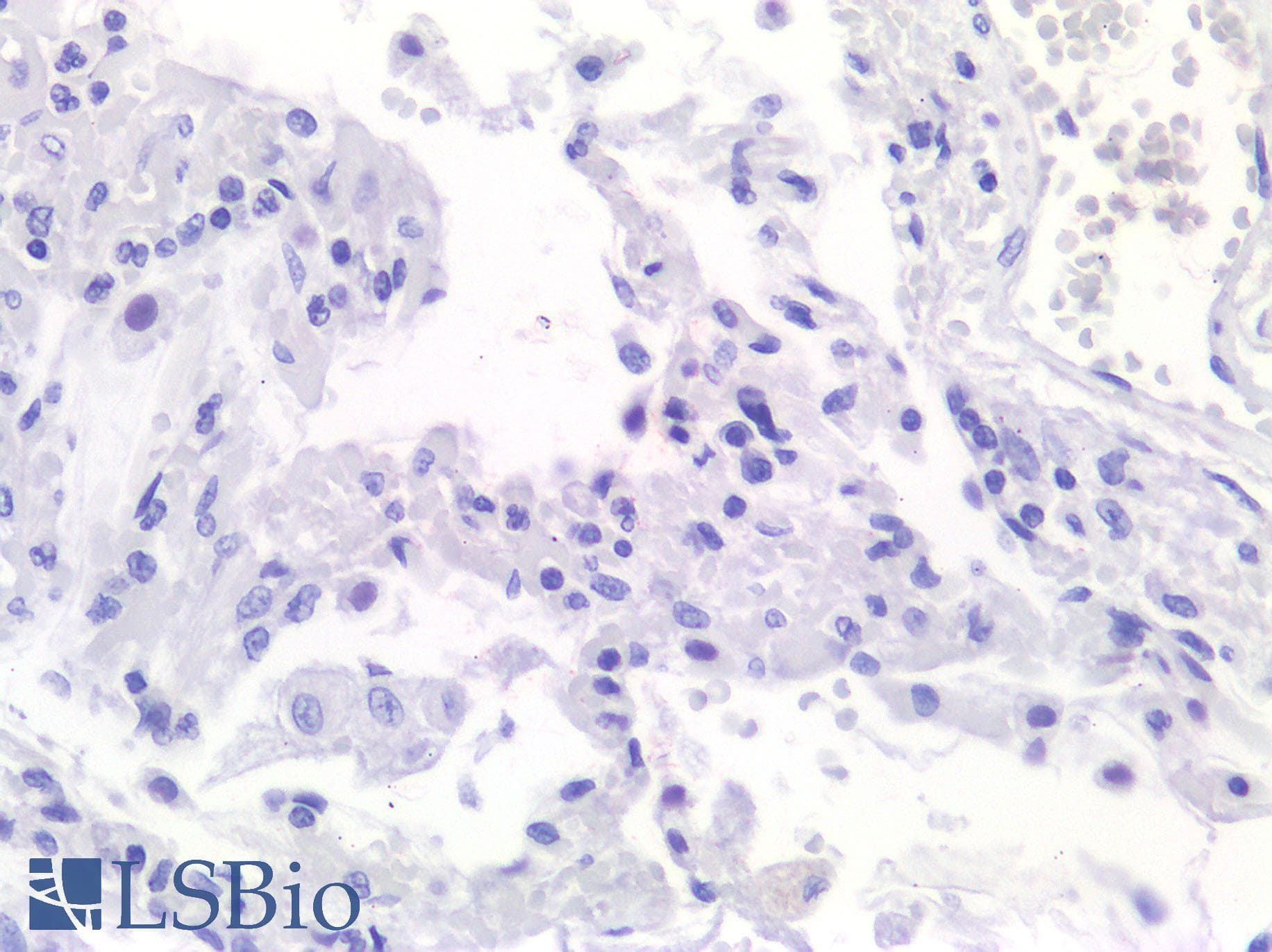 IHC-plus™ ACE2 / ACE-2 Antibody (aa140-172)