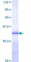 Human PBX1 Protein (Recombinant GST, N-terminus)