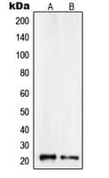RCAN1 / DSCR1 Antibody (C-Terminus)