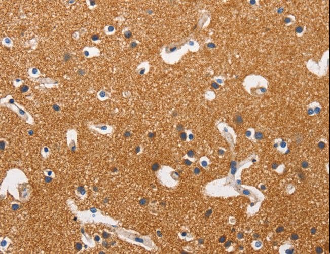 HK2 / Hexokinase 2 Antibody