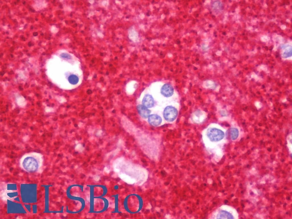 IHC-plus™ SYN1 / Synapsin 1 Antibody (aa668-697)