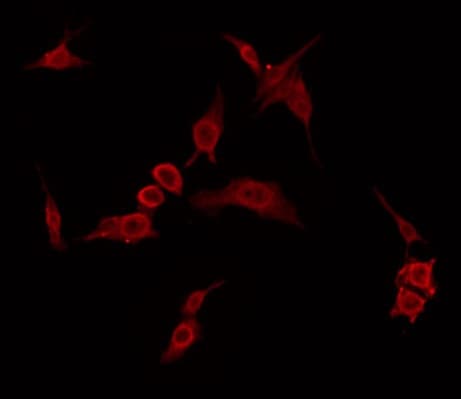 Polyclonal Rabbit anti-Human ARMCX2 Antibody (IF, WB)