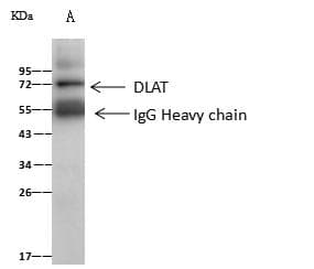 DLAT / PDC-E2 Antibody (Preservative Free)