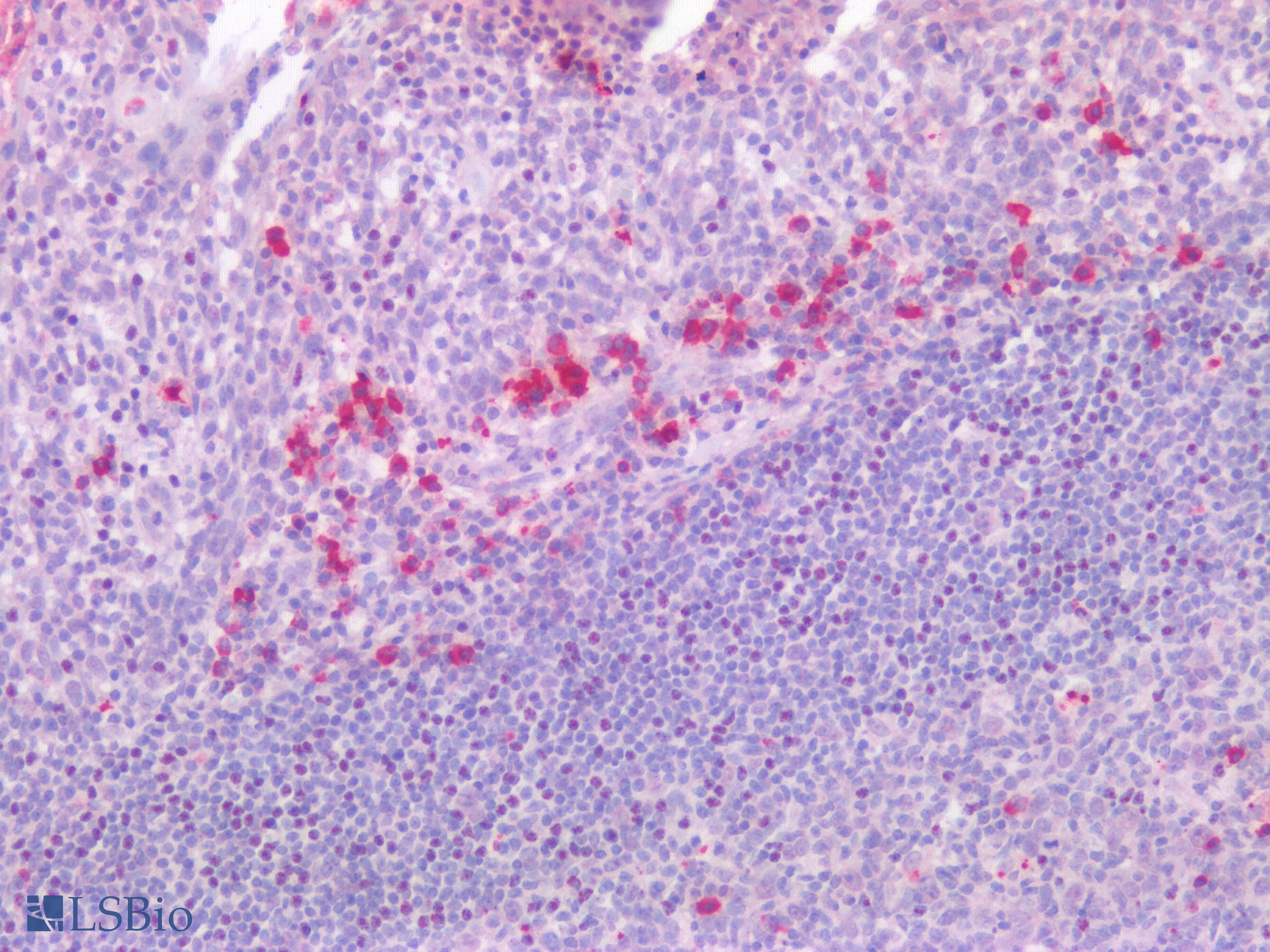 IHC-plus™ ISG15 Antibody
