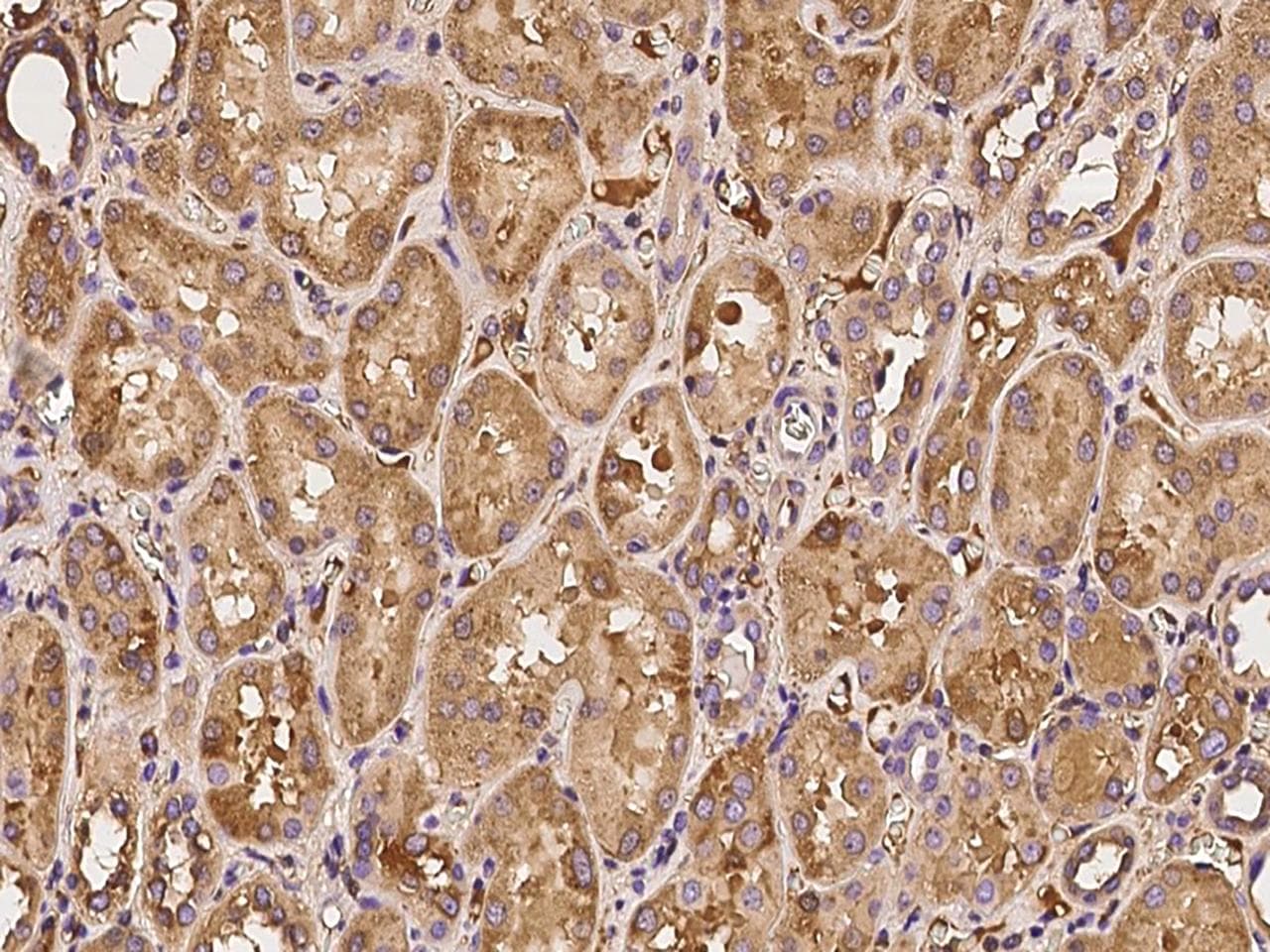 KNG1 / Kininogen / Bradykinin Antibody