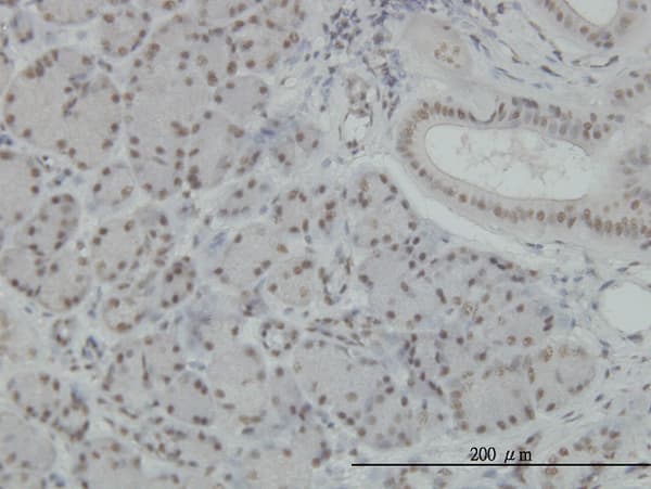 NFKB1 / NF-Kappa-B Antibody (clone 3F6)