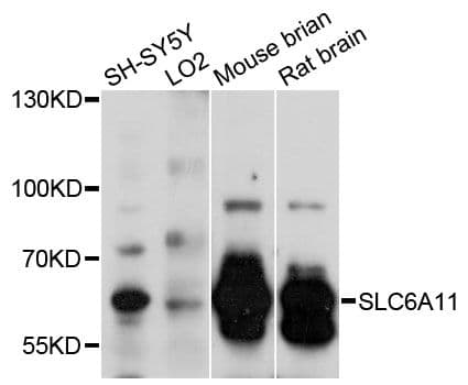 SLC6A11 / GAT-3 Antibody