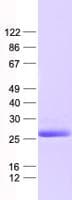 Human ANGPTL8 / Betatrophin Protein (Recombinant His,C-terminus)