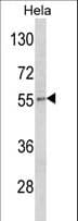 DFNA5 Antibody (aa59-87)