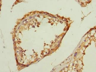 TMED10 / TMP21 Antibody
