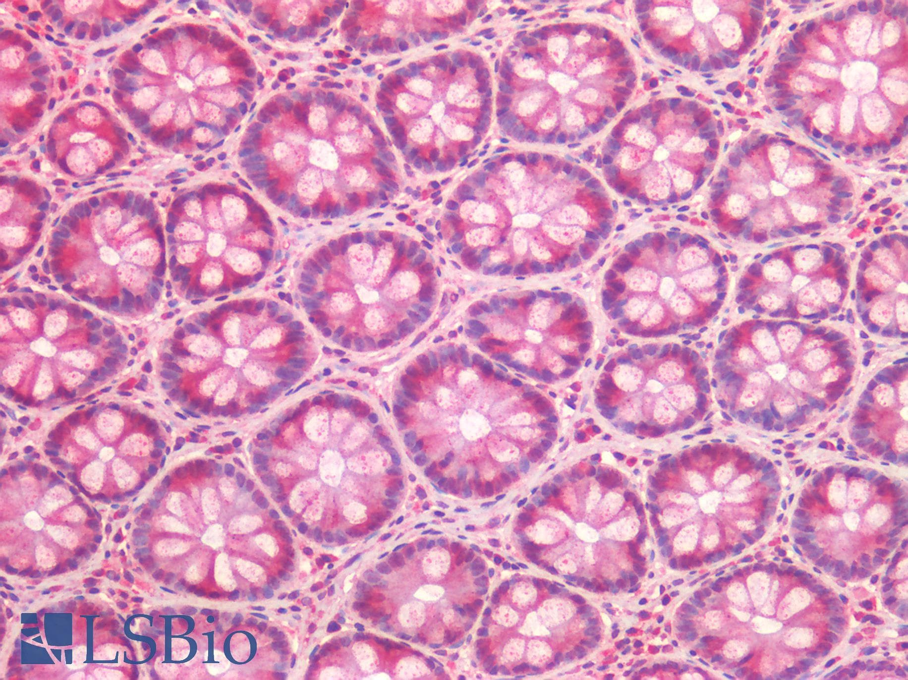 IHC-plus™ Polyclonal Rabbit anti-Human ALK2 / ACVR1 Antibody (IHC)