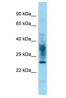 FAM167A Antibody (aa146-195)