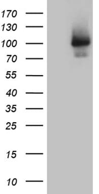 Monoclonal Mouse anti-Human ALS2CR11 Antibody (clone OTI7A8, aa307-623, WB)