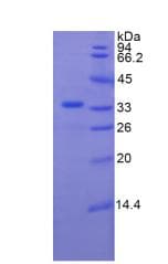 Human PLXNB1 / Plexin-B1 Protein (Recombinant His-T7)