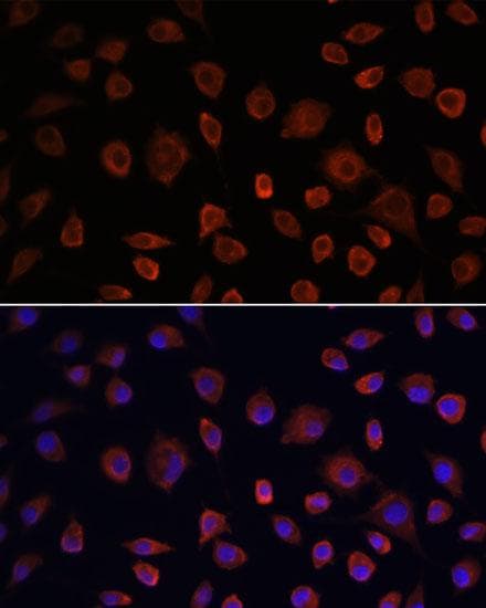 ULK1 Antibody