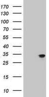 Monoclonal Mouse anti-Human IF3mt / MTIF3 Antibody (clone OTI1D6, IHC, WB)