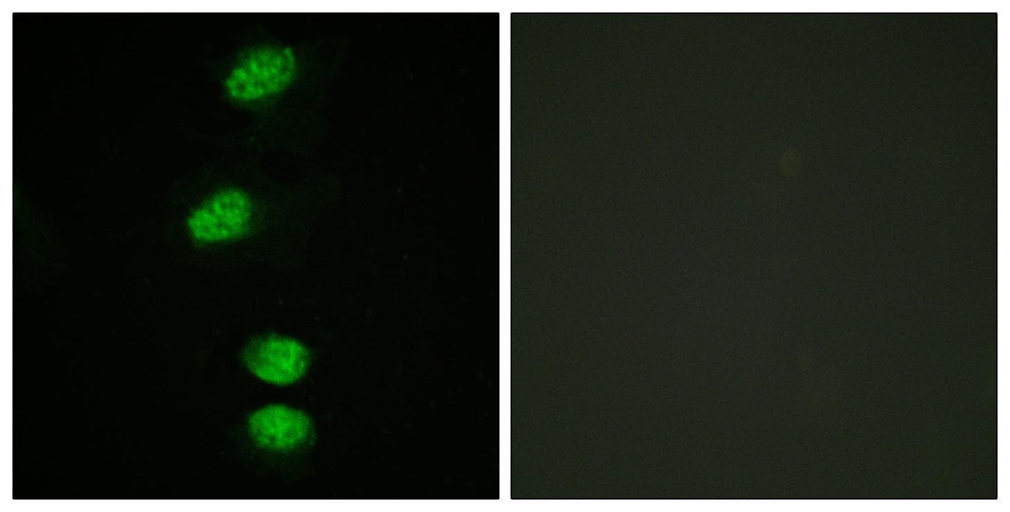 AR / Androgen Receptor Antibody (phospho-Ser94)