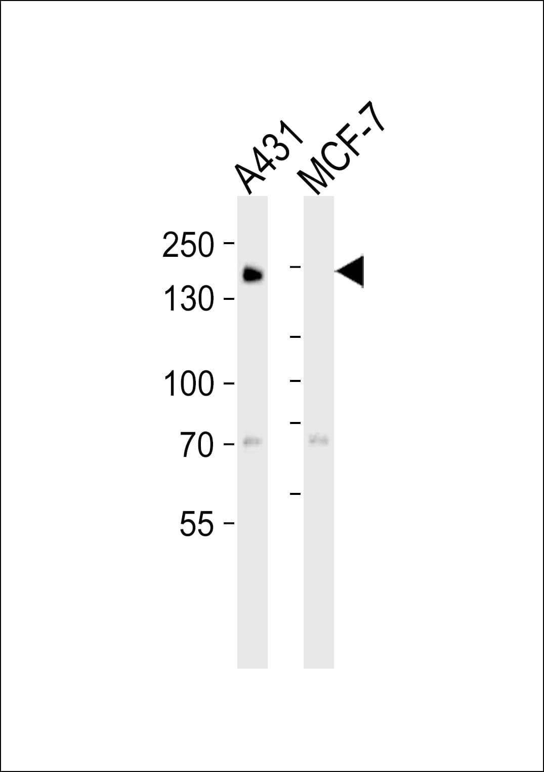 Monoclonal Mouse anti-Human EGFR Antibody (aa1163-1191, IHC, WB)