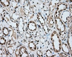 ERCC1 Antibody (clone OTI1G6)