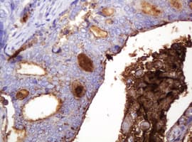 TAG-72 Antibody (clone CC49)