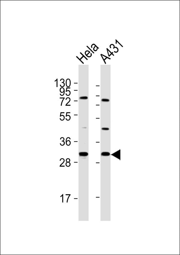 Polyclonal Rabbit anti-Human RPS4X + RPS4Y1 + RPS Antibody (WB)