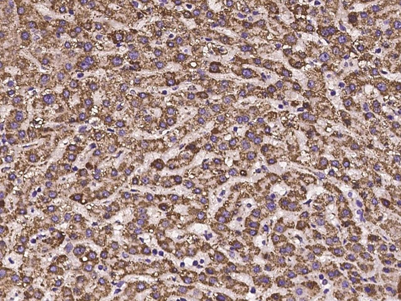 HIBADH Antibody