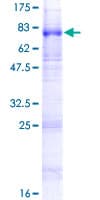 Human SLC22A8 / OAT3 Protein (Recombinant GST)