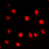 CLK1 / CLK Antibody (Internal)