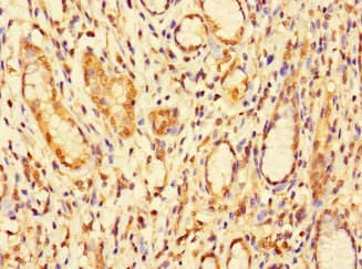 Polyclonal Rabbit anti-Human DBR1 Antibody (IHC)