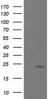 RAB21 Antibody (clone OTI6G1)