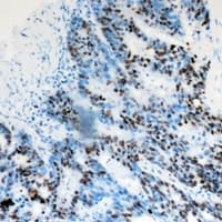 DACH / DACH1 Antibody