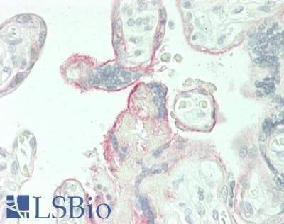 PathPlus™ MME / CD10 Antibody (clone 56C6)