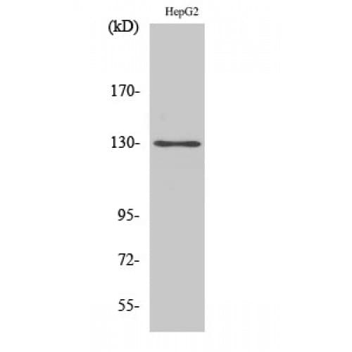 Polyclonal Rabbit anti-Human BCAR1 / p130Cas Antibody (100-180 aa, IHC, WB)