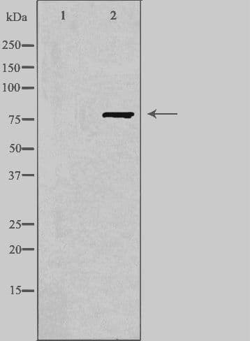 FZD6 / Frizzled 6 Antibody