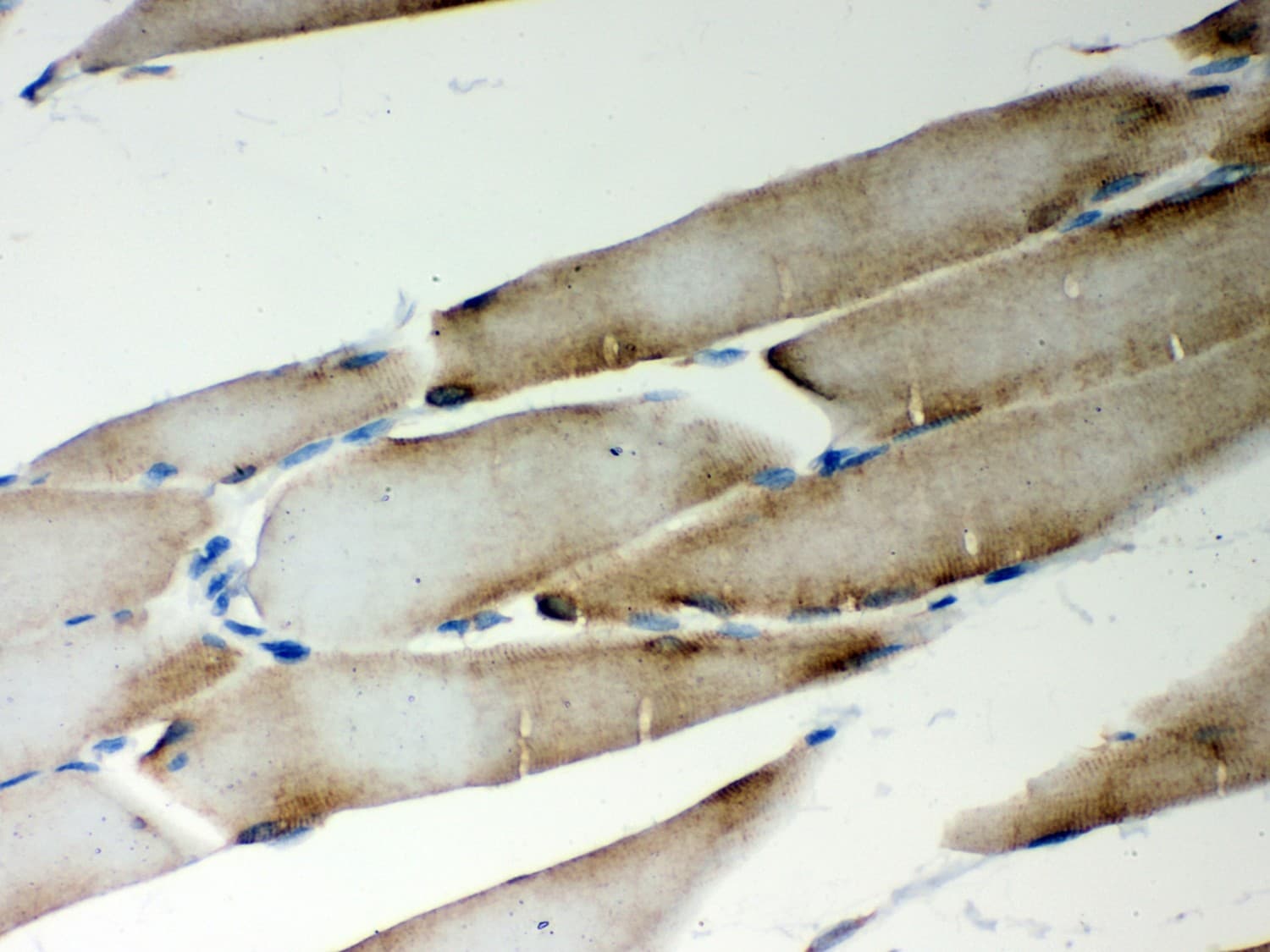 Polyclonal Rabbit anti-Human MTDH / Metadherin Antibody (aa101-270, IHC, WB)
