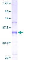 Human HAVCR2 / TIM-3 Protein (Recombinant GST)