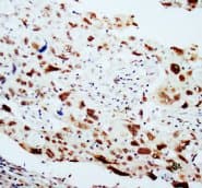 DNAJB1 / Hsp40 Antibody (C-Terminus)