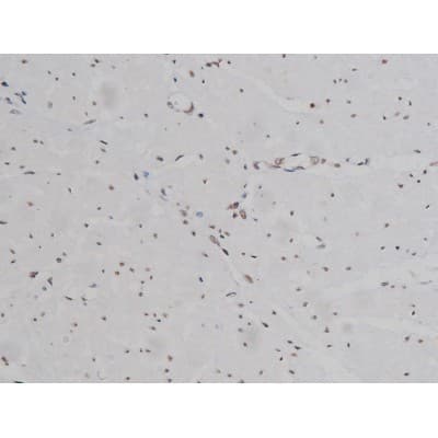 IGF1R / IGF1 Receptor Antibody (phospho-Tyr1346)