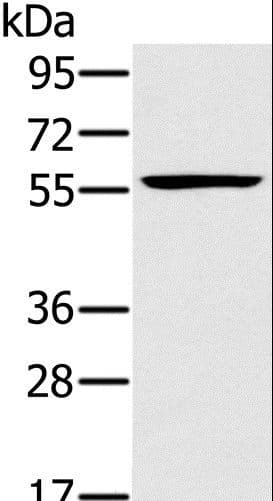 TRIM34 / RNF21 Antibody