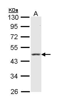 PathPlus™ Polyclonal Rabbit anti-Human KRT18 / CK18 / Cytokeratin 18 Antibody (IHC, IF, WB)